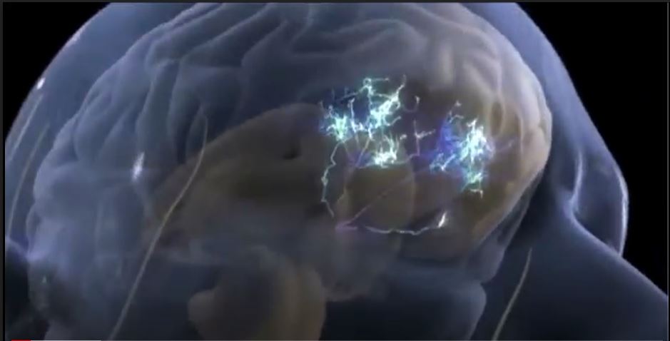 Cerebro