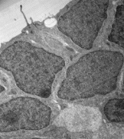 Cerebro de Austrolebias charrúa 2