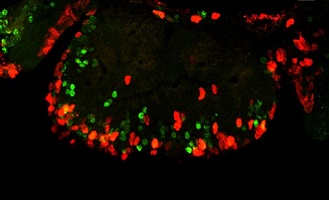 Cerebro de Austrolebias charrúa 3