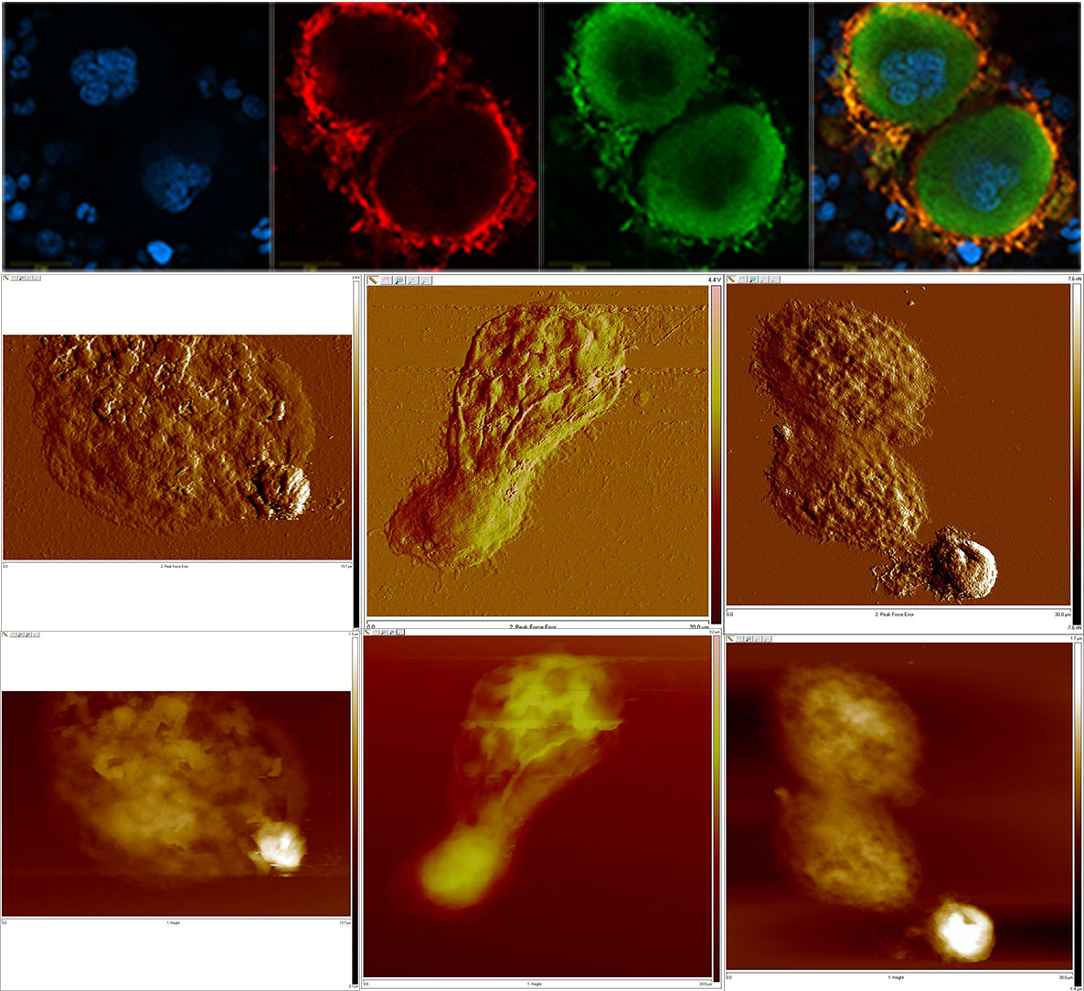 Investigación y diagnóstico en hematología