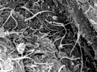 Luz ventricular Tectum óptico MEB