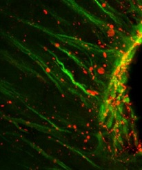 Luz ventricular telencéfalo