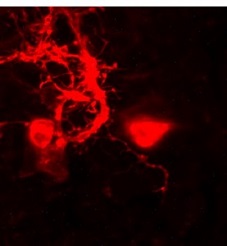 Neuronas marcadas por transporte