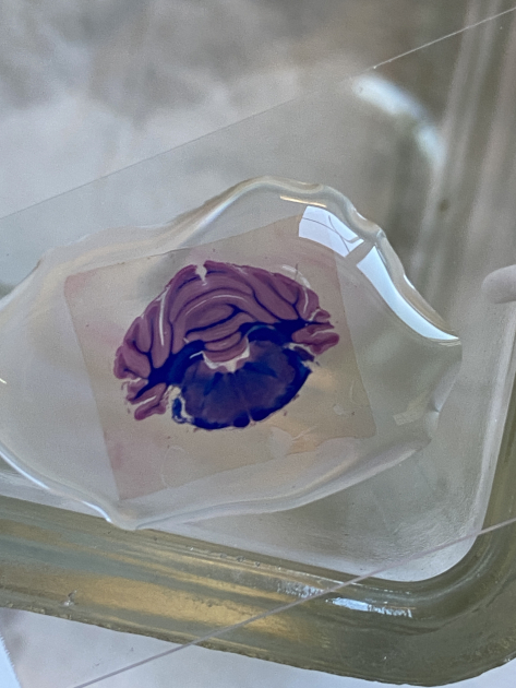 Cerebelo de rata durante la tinción: mielina en azul y neuronas y glía en fucsia. Cerebelo de rata durante la tinción: mielina en azul y neuronas y glía en fucsia.