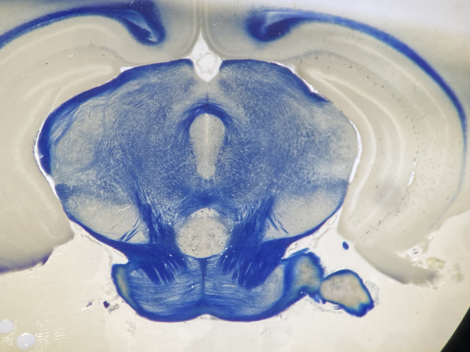 Cerebro de cerebro de ratón teñido con eriocromo cianina R para visualizar la mielina.