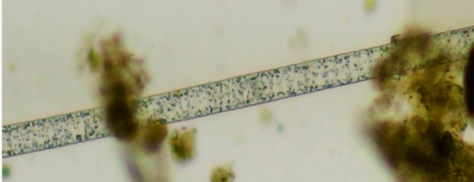 Detalle de las bacterias halladas vistas al microscopio