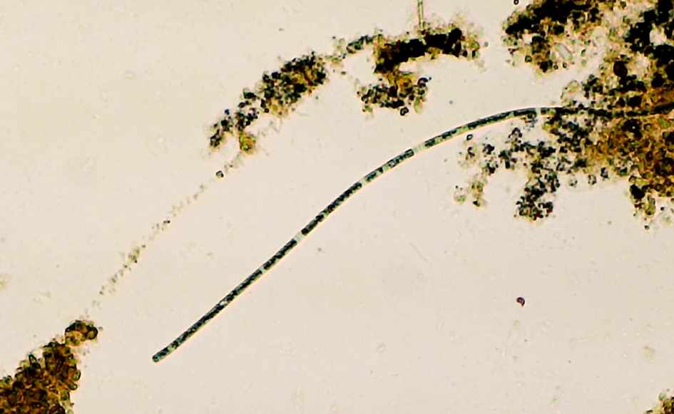 Bacterias halladas vistas al microscopio