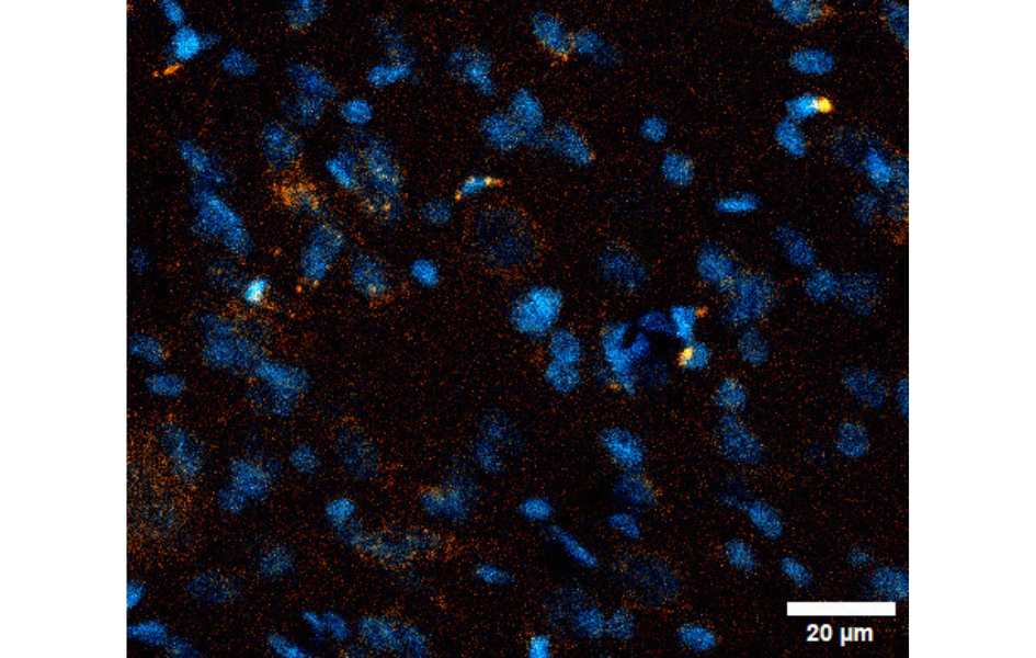 Microscopía confocal del Locus coeruleus: núcleos en azul y MCH conjugada con rodamina en rojo. Microscopía confocal del Locus coeruleus: núcleos en azul y MCH conjugada con rodamina en rojo.