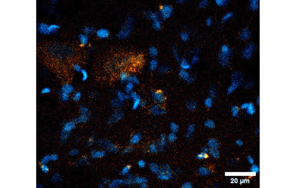 Microscopía confocal del Locus coeruleus: núcleos en azul y MCH conjugada con rodamina en rojo. Microscopía confocal del Locus coeruleus: núcleos en azul y MCH conjugada con rodamina en rojo.