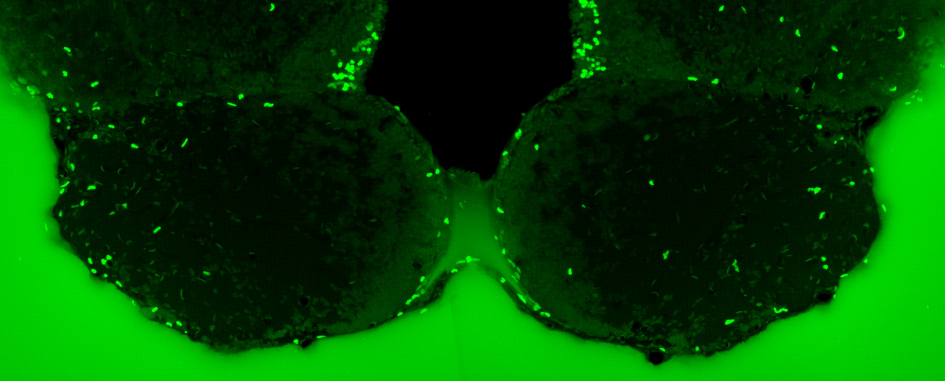 Imagen de material observado al microscopio