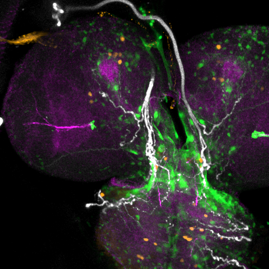 Imagen del cerebro de una larva de la mosca Drosophila Imagen del cerebro de una larva de la mosca Drosophila