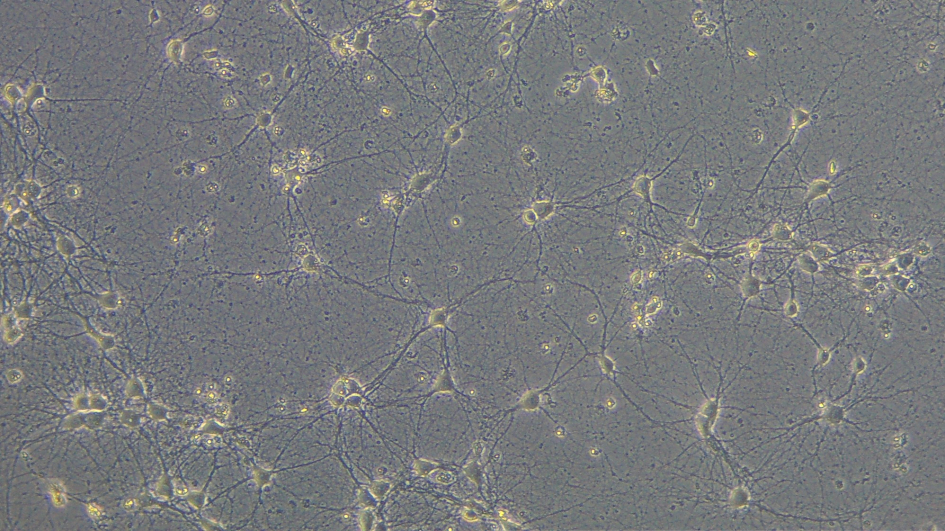 Cultivo de neuronas embrionarias de ratón Cultivo de neuronas embrionarias de ratón