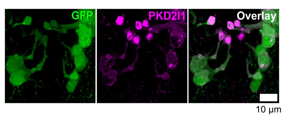 Neuronas que contactan el líquido cefalorraquídeo, en verde, y el canal PKD2L1, en violeta