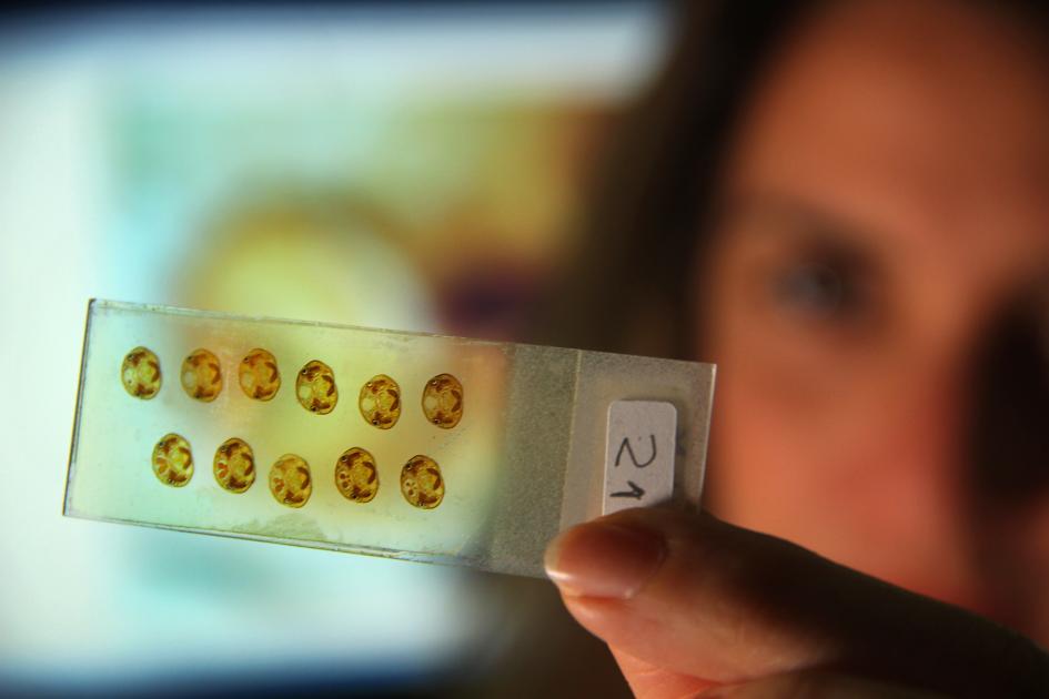 Investigadora del IIBCE estudiando muestras de cerebro de pez Investigadora del IIBCE estudiando muestras de cerebro de pez