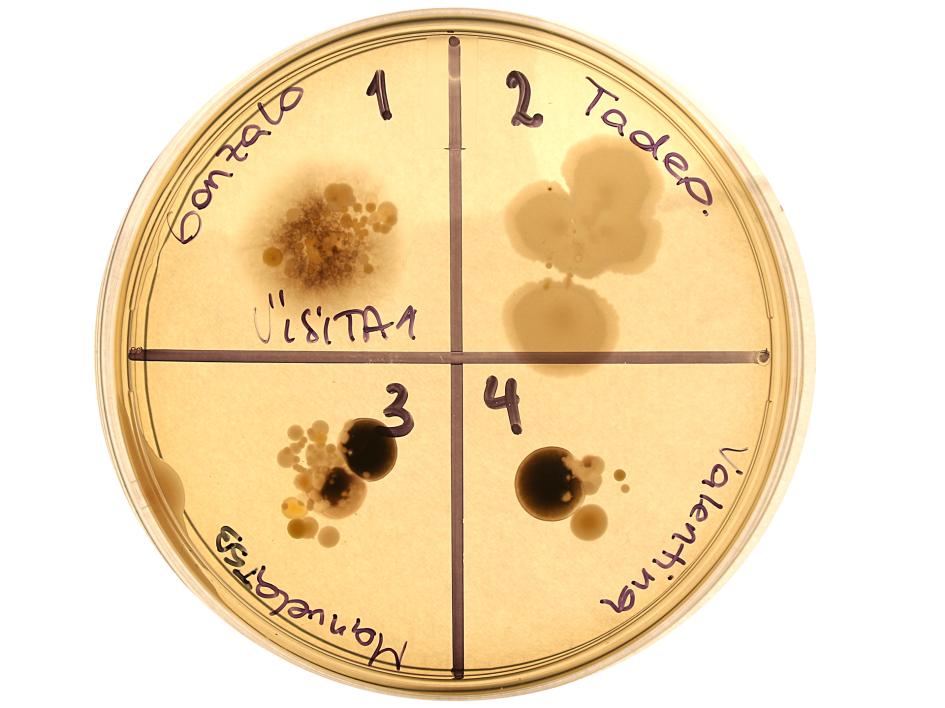 Cultivo de bacterias de los dedos 1 Cultivo de bacterias de los dedos 1