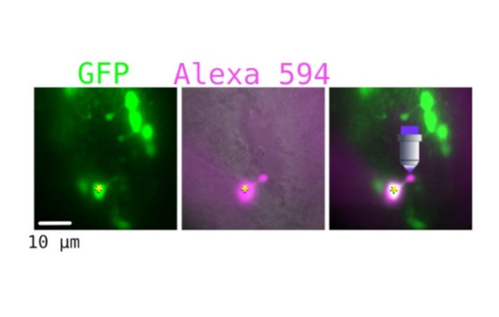 Neuronas que contactan en líq. cefalorraquídeo en verde. Neurona en magenta. Lugar de desenjaulado. Neuronas que contactan en líq. cefalorraquídeo en verde. Neurona en magenta. Lugar de desenjaulado.