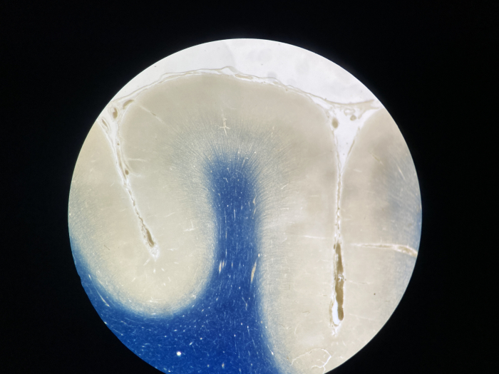 Corteza cerebral humana: la mielina se observa en azul con eriocromo cianina R.