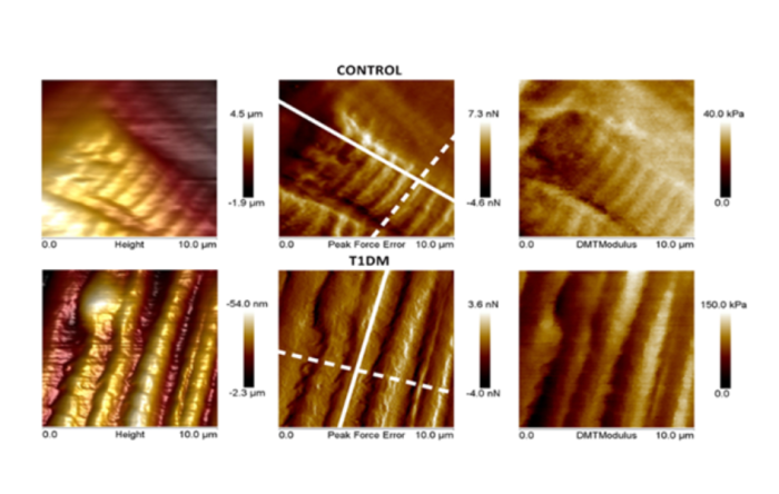 Mapas de topografía y elasticidad de cardiomiocitos vivos de ratones control y T1DM Mapas de topografía y elasticidad de cardiomiocitos vivos de ratones control y T1DM