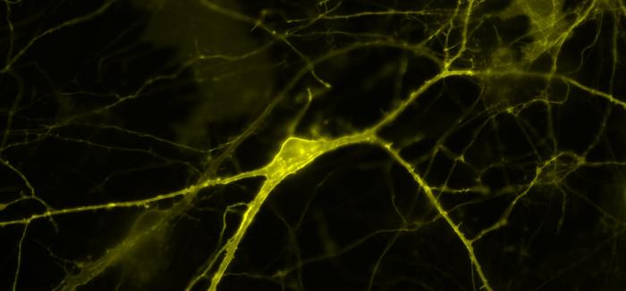 Neuronas conectadas mediante sus dendritas y axones Neuronas conectadas mediante sus dendritas y axones