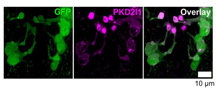 Neuronas que contactan el líquido cefalorraquídeo, en verde, y el canal PKD2L1, en violeta Neuronas que contactan el líquido cefalorraquídeo, en verde, y el canal PKD2L1, en violeta