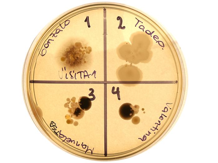 Cultivo de bacterias de los dedos 1