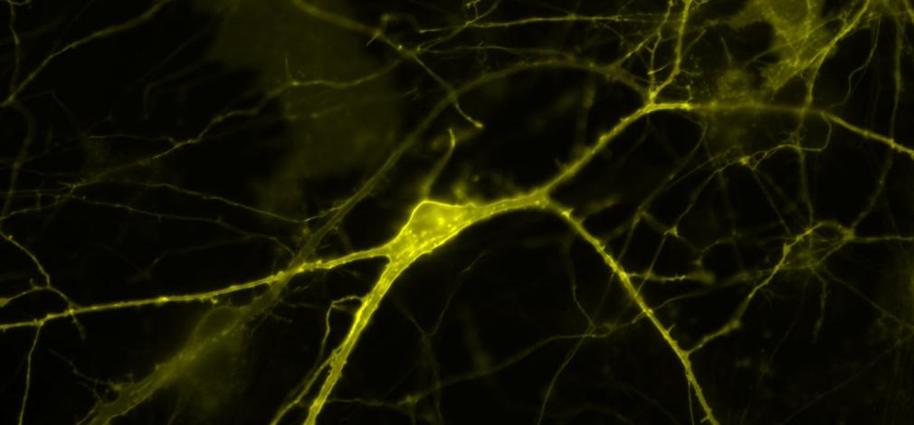 Neuronas conectadas mediante sus dendritas y axones