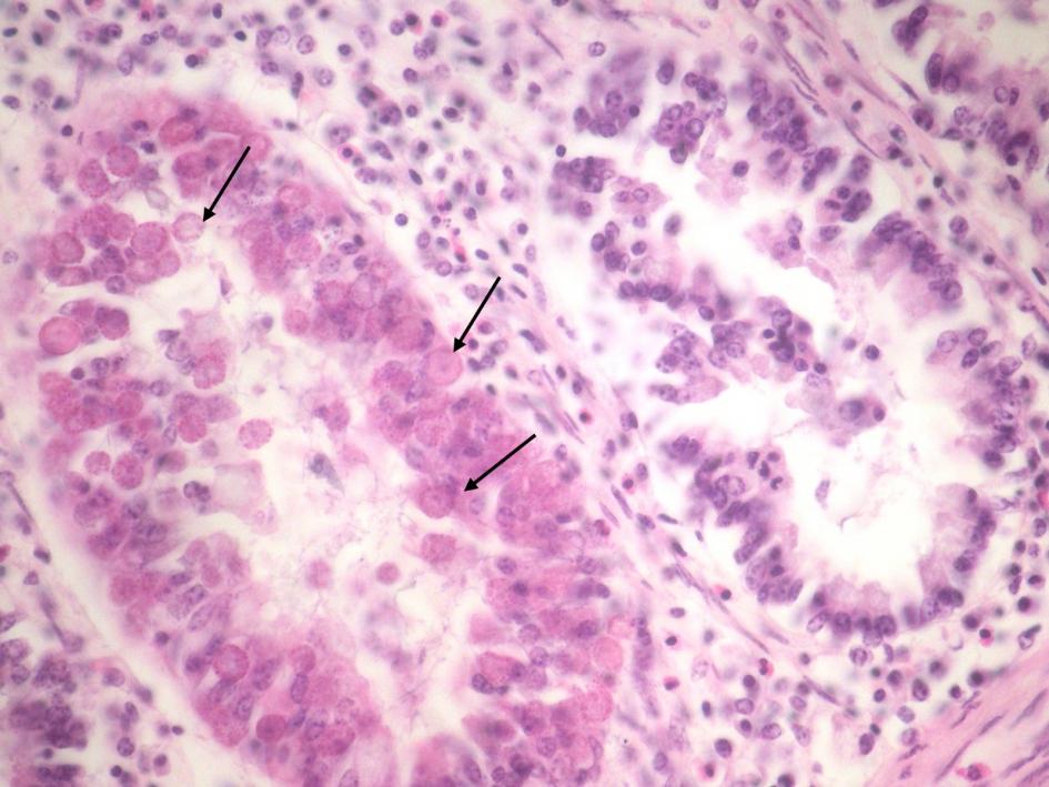 Fig. 7 - Coccidiosis - Eimeria en intestino Fig. 7 - Coccidiosis - Eimeria en intestino