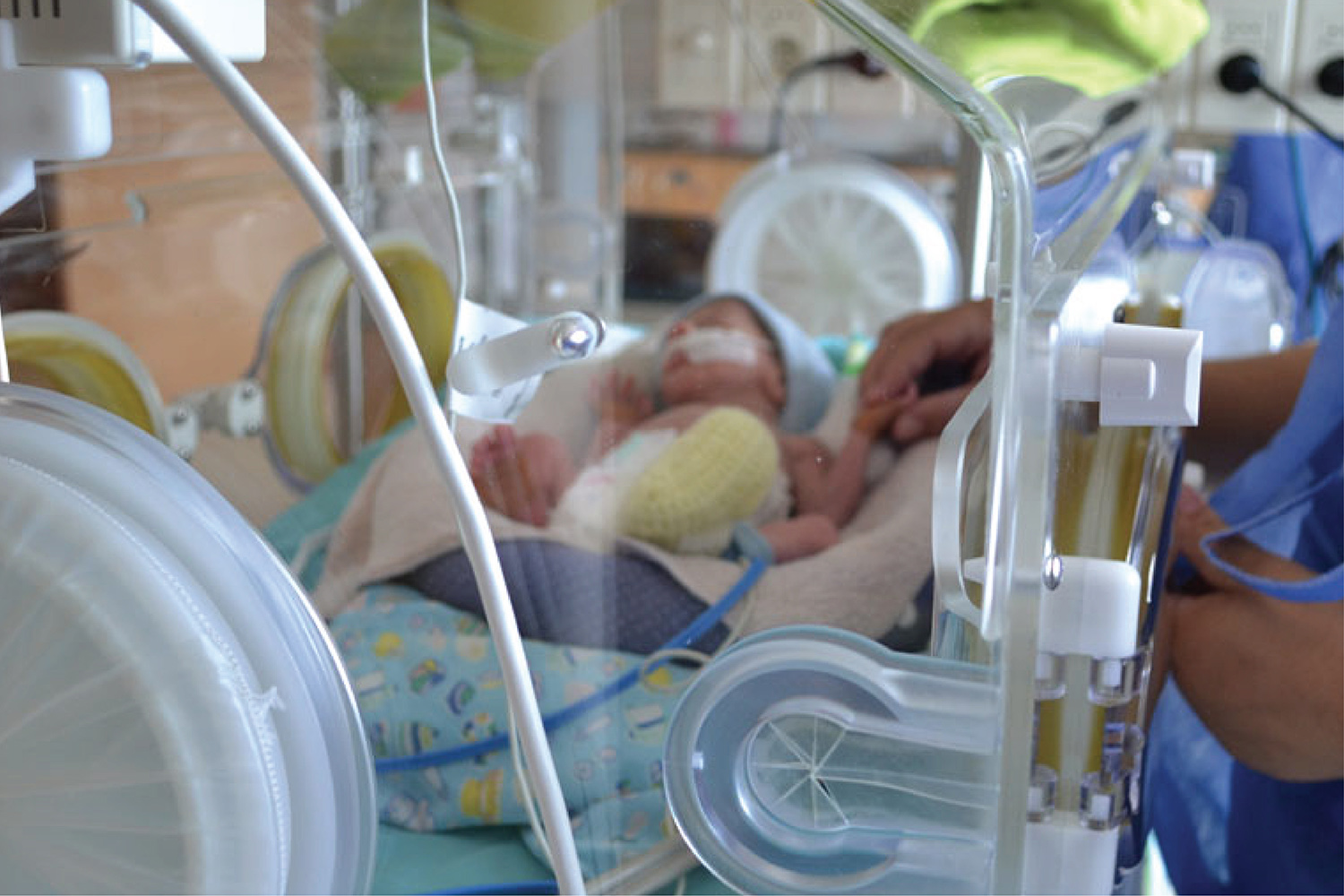 Bebé prematuro en incubadora