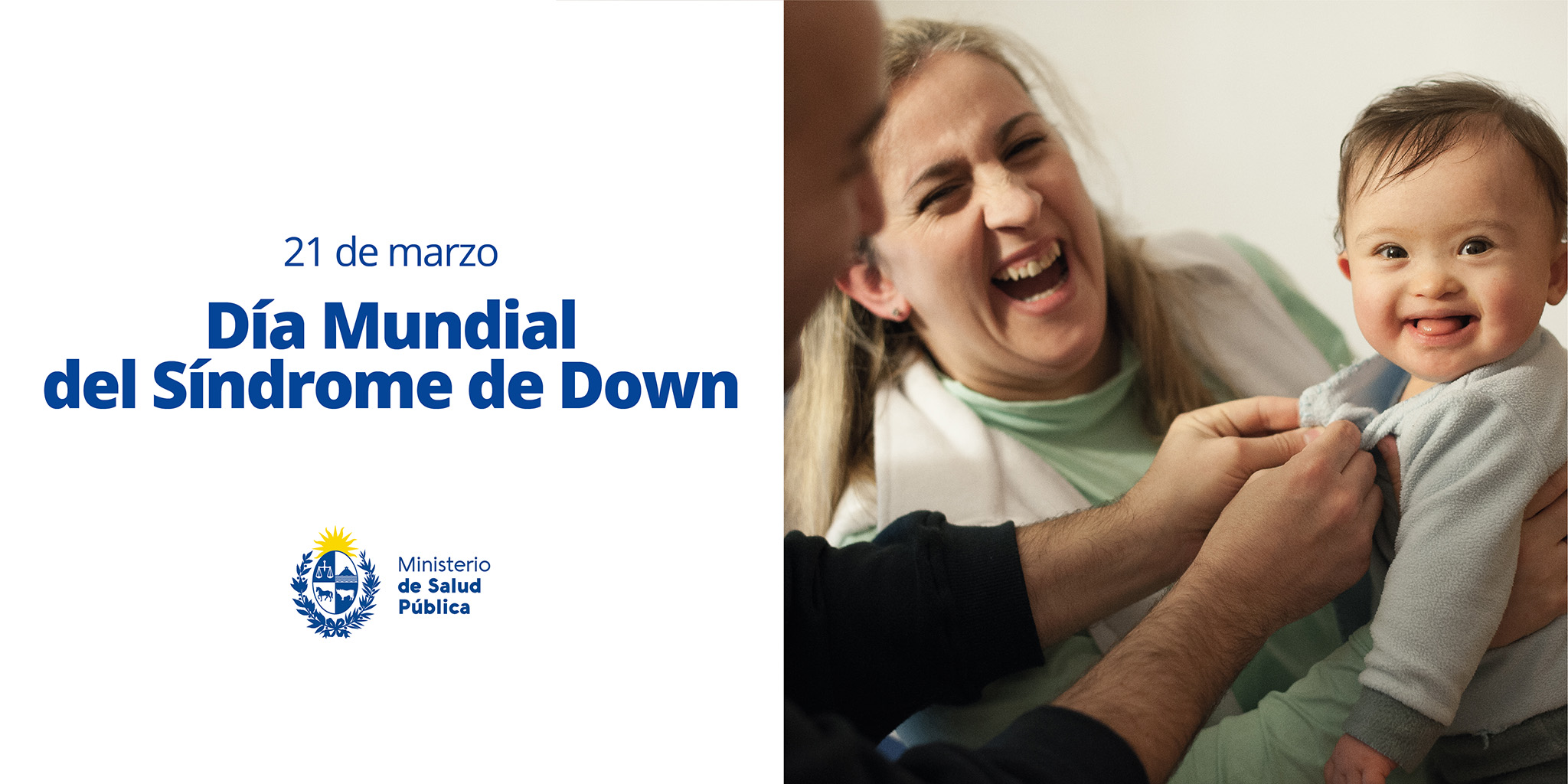 En una ecografia se puede detectar el sindrome de down