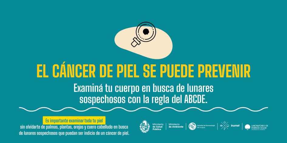 Campaña de prevención de cáncer de piel 11 Examiná tu cuerpo en busca de lunares sospechosos con la regla del ABCDE.