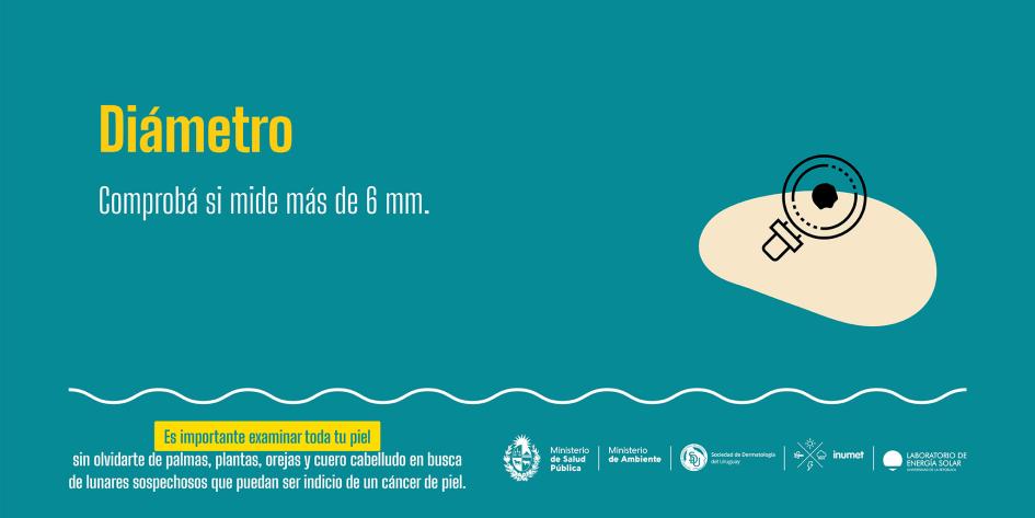 Campaña de prevención de cáncer de piel 15 Diámetro. Comprobá si mide más de 6 mm.