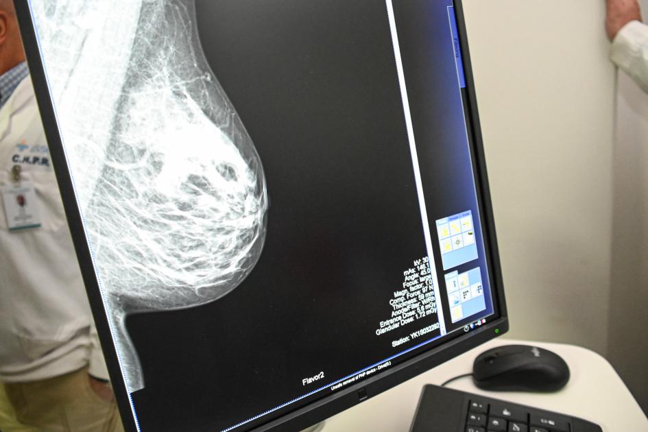 Imagen de una mamografía Imagen de una mamografía