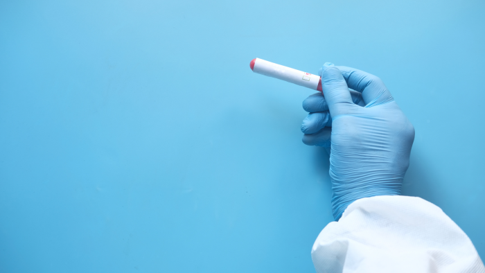 Mano con guante azul sostiene muestra de sangre