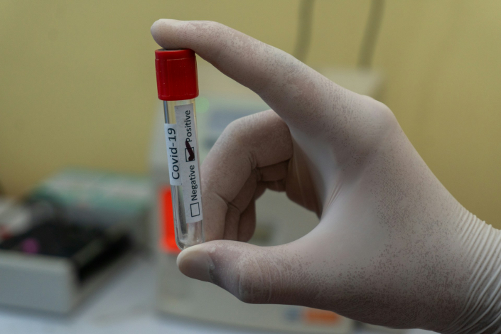 Mano con guante sostiene un tubo de recolección de muestra con etiqueta covid-19 positivo