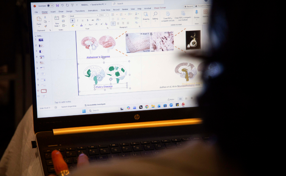 Laptop abierta. En la pantalla, se observan imágenes con cortes transversales de cerebros