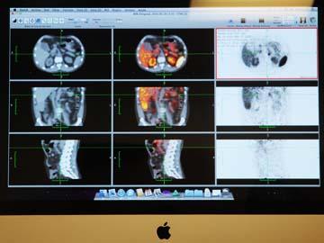 Software de imagenología en el CUDIM Software de imagenología en el CUDIM
