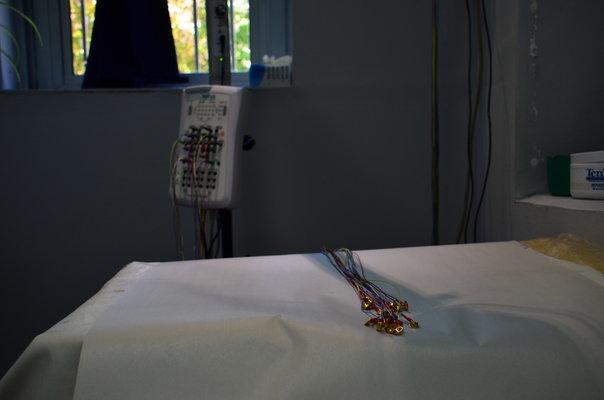 Nuevo electroencefalógrafo del Hospital Vilardebó