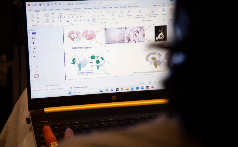 Laptop abierta. En la pantalla, se observan imágenes con cortes transversales de cerebros