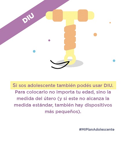 Podés usar el DIU aunque seas adolescente, ya que para colocarlo no importa tu edad, sino la medida de tu útero. Además, si tu útero no tiene la medida estándar, también hay dispositivos más pequeños. 